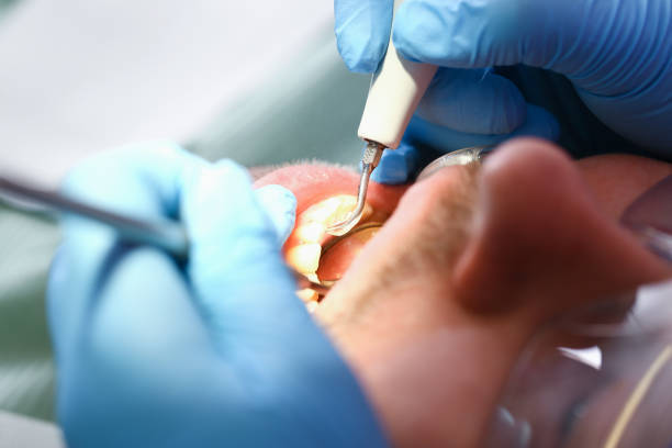 Best Emergency Treatment for Jaw Pain or Injury in Rising Sun, MD