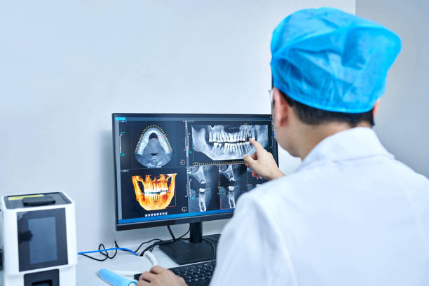 Best Emergency Wisdom Tooth Extraction in Rising Sun, MD